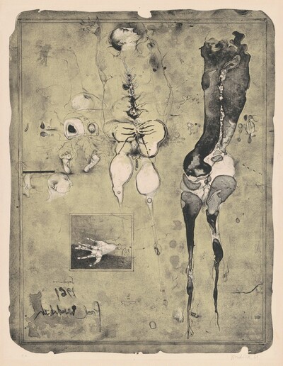 Anatomie 61 (Anatomy 61)
