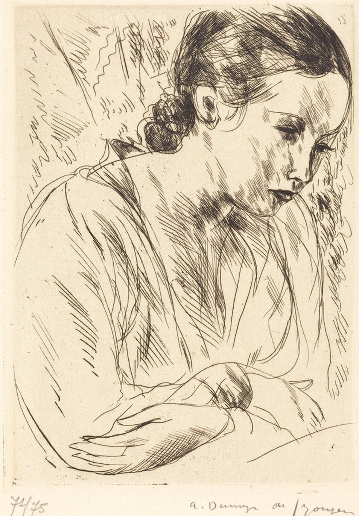 Fernande with Arms Crossed, Large Plate (Fernande les mains croisees (grande planche) by André Dunoyer de Segonzac